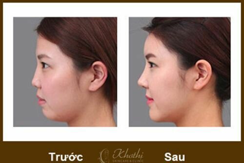 mui-sline6