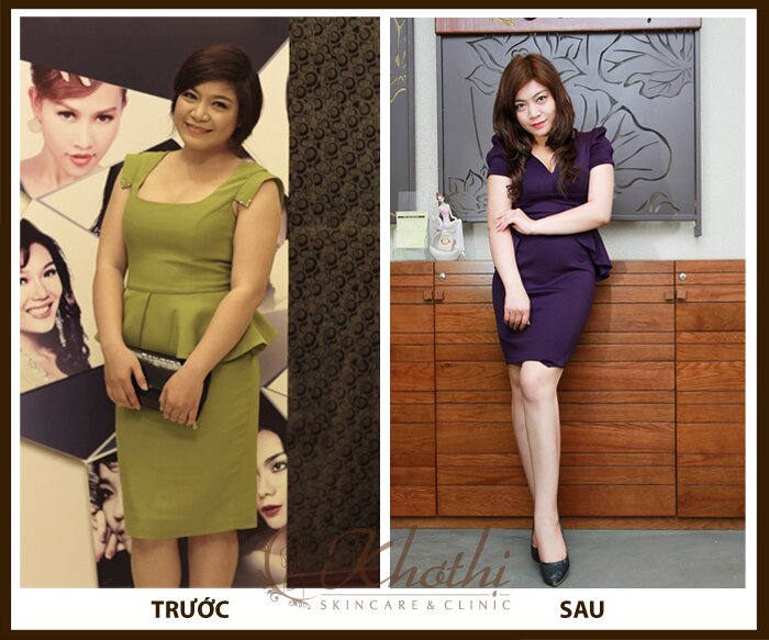 cong-nghe-giam-can-nhanh5